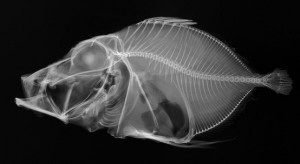 xray1